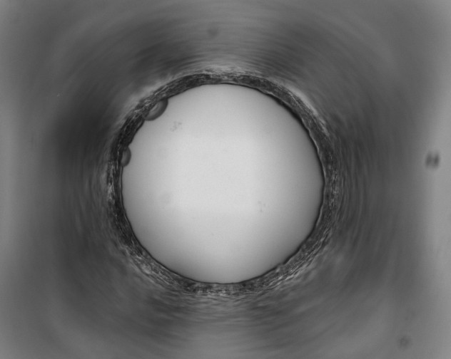 X0000099581016200806061622