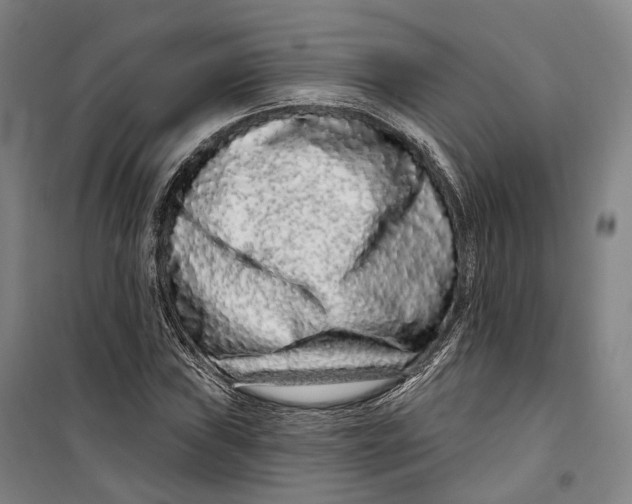 X0000099581019200806061622