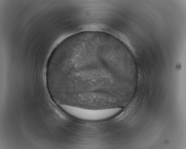 X0000099581035200806061622