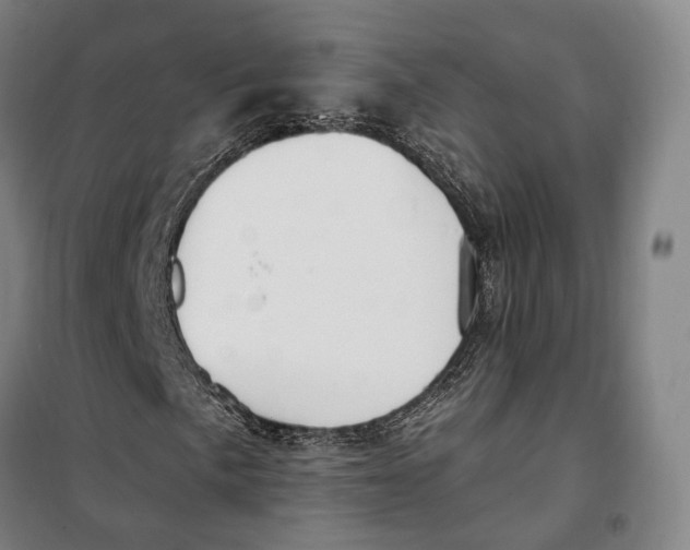 X0000099581057200806061622