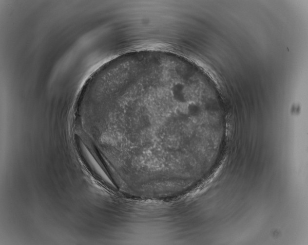 X0000099581117200806061620