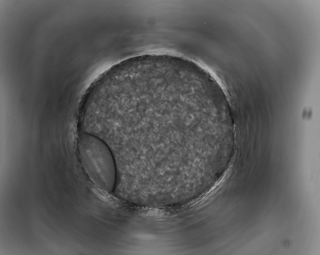 X0000099581263200806061618