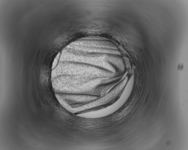 X0000099581300200806061617