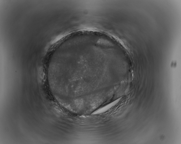 X0000099581303200806061617