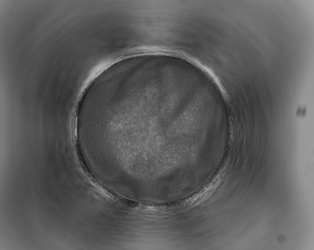 X0000099581365200806061617