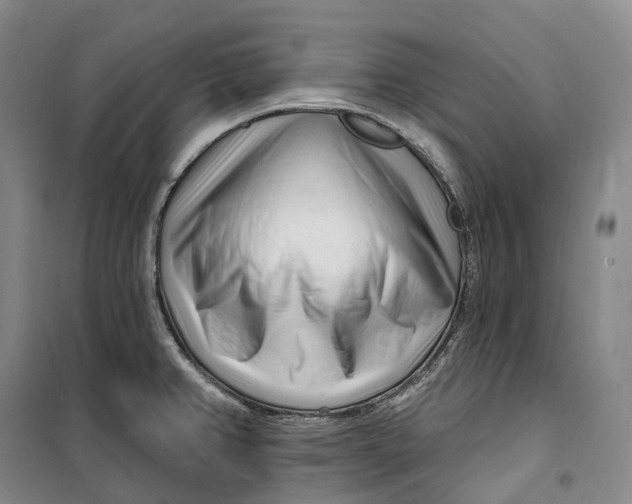 X0000099581382200806061617