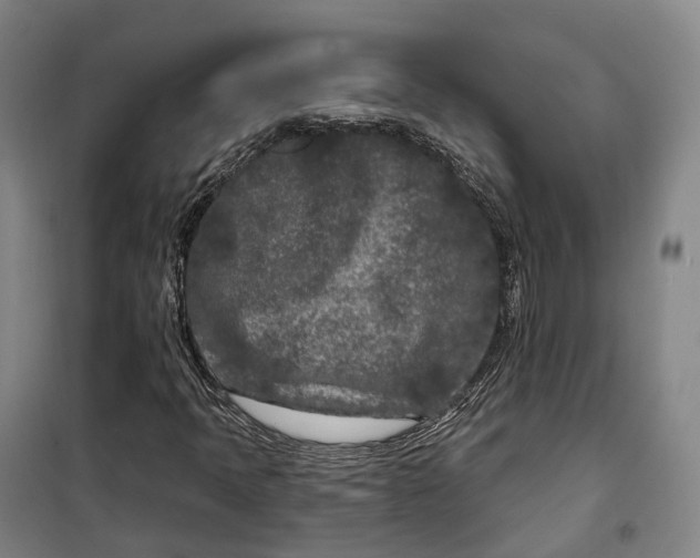 X0000099581397200806061616