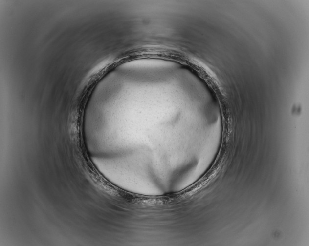 X0000099581403200806061616