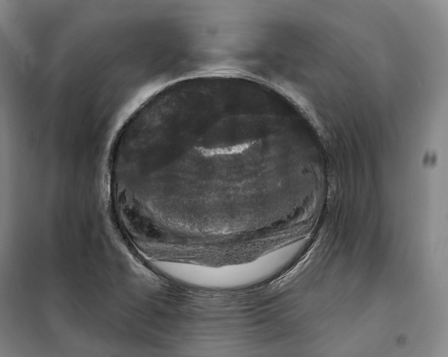 X0000099581414200806061616