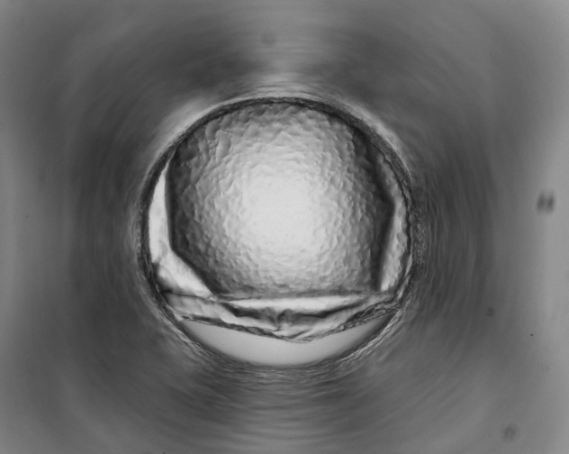 X0000099581415200806061616