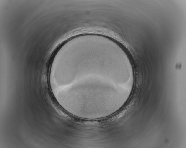 X0000099581498200806061614