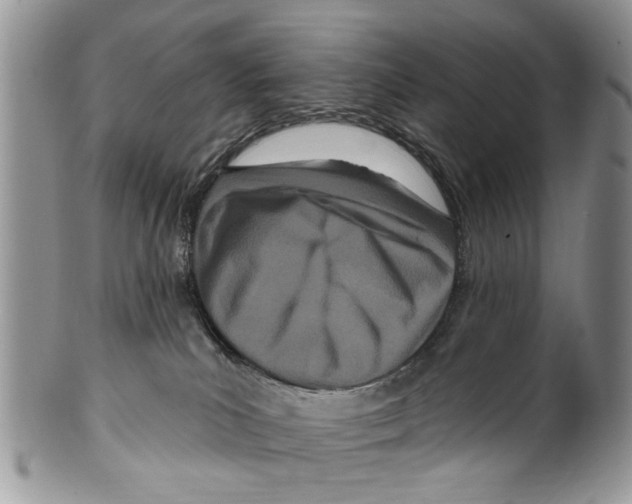 X0000099580039200806131328