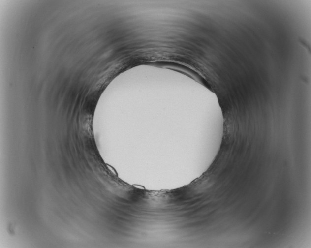 X0000099580141200806131326