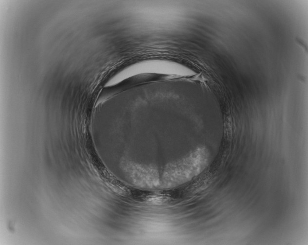 X0000099580504200806131321