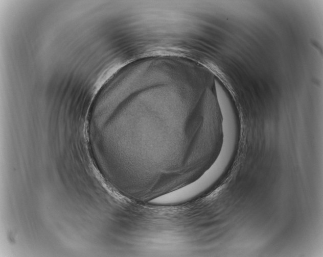 X0000099580893200806131315