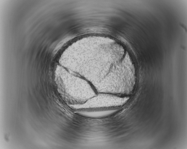 X0000099581019200806131313