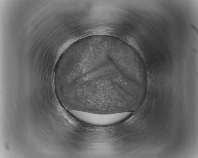 X0000099581035200806131313