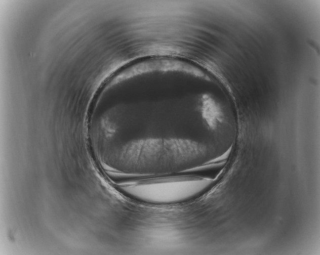 X0000099581037200806131313