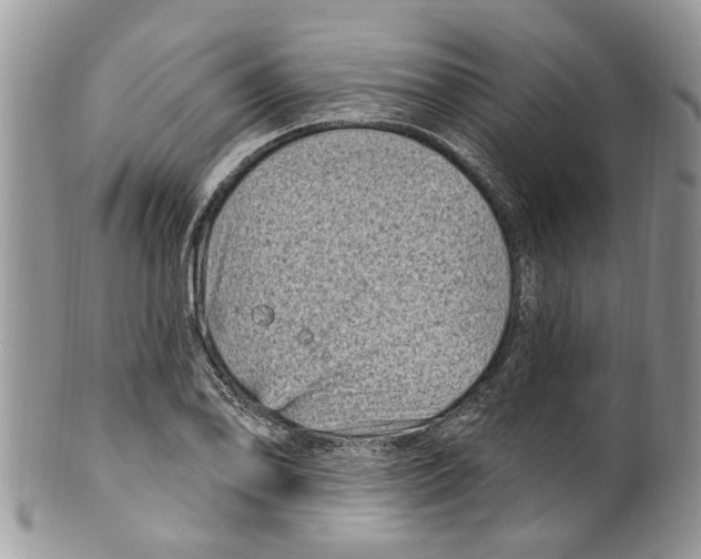 X0000099581078200806131313