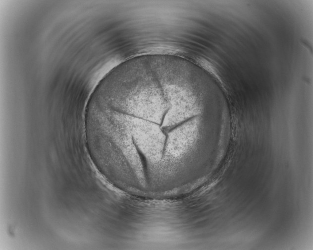 X0000099581087200806131313