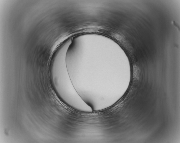 X0000099581164200806131311