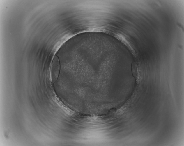 X0000099581276200806131310