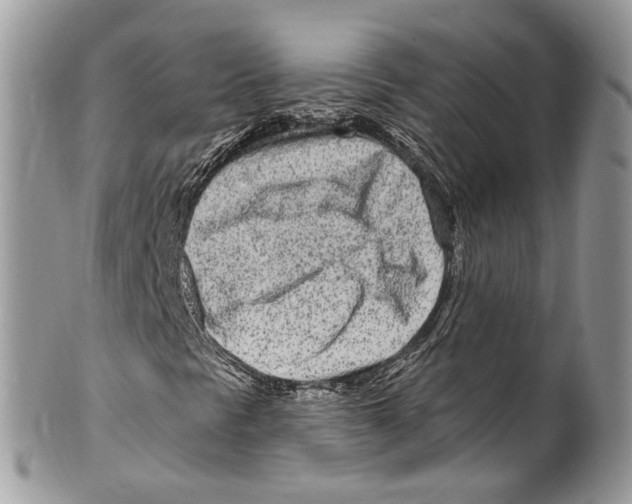 X0000099581297200806131309