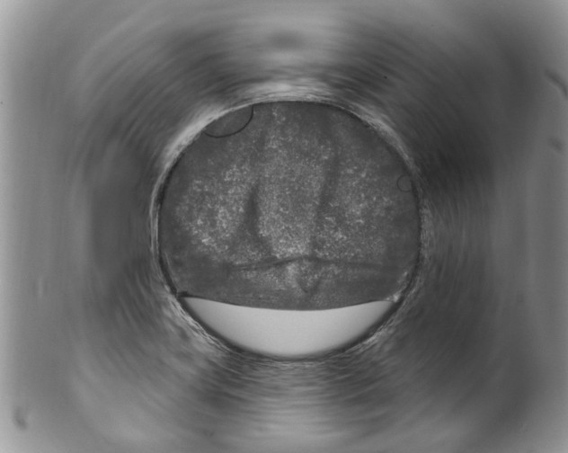 X0000099581419200806131308