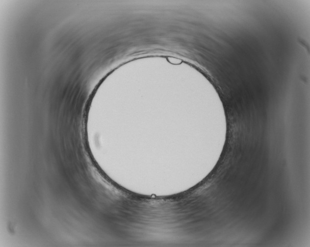 X0000099581518200806131307