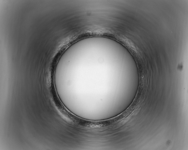 X0000099930638200805231000