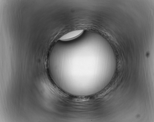 X0000099930661200805231000