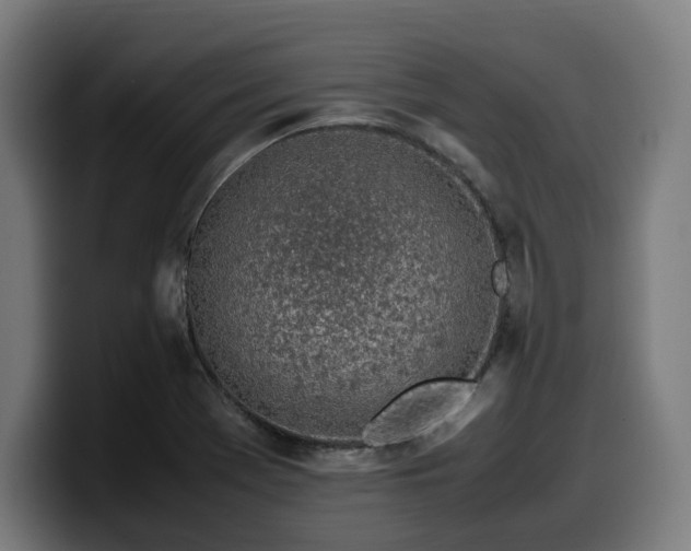 X0000099931369200805301150