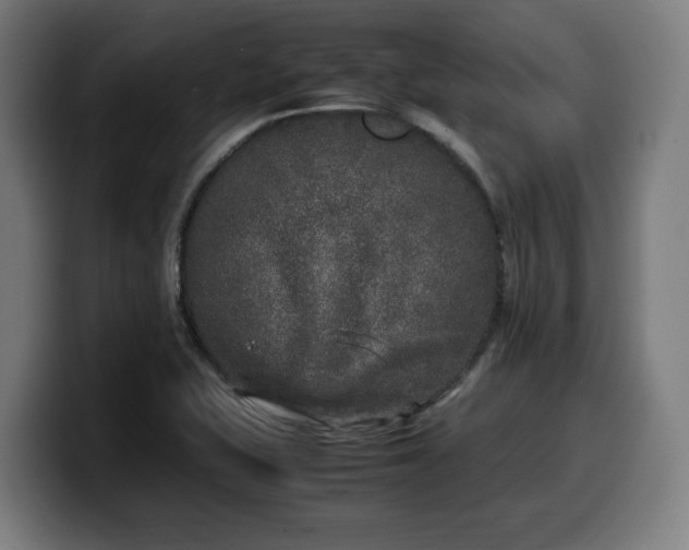 X0000099931415200805301149