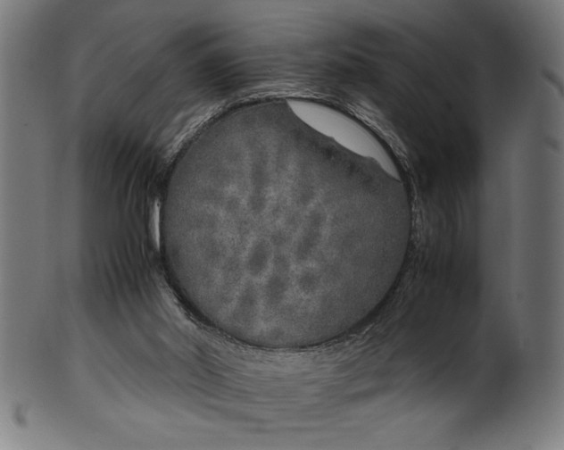 X0000099930014200806061505