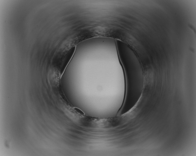 X0000099930186200806061503