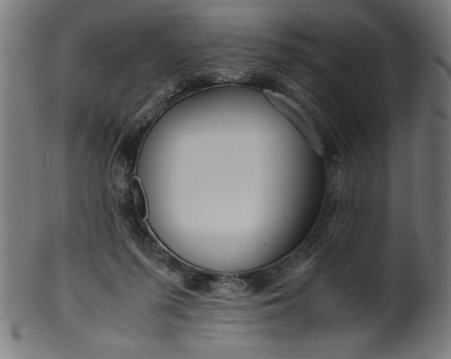 X0000099930215200806061502