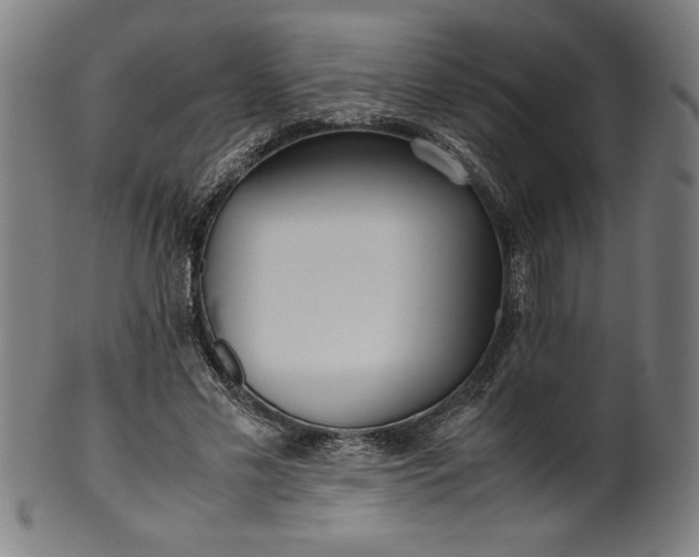 X0000099930589200806061456