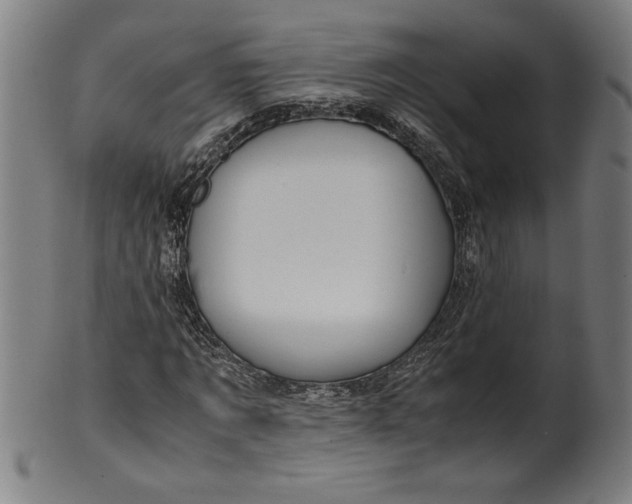 X0000099930869200806061452