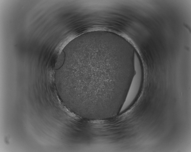 X0000099930953200806061451