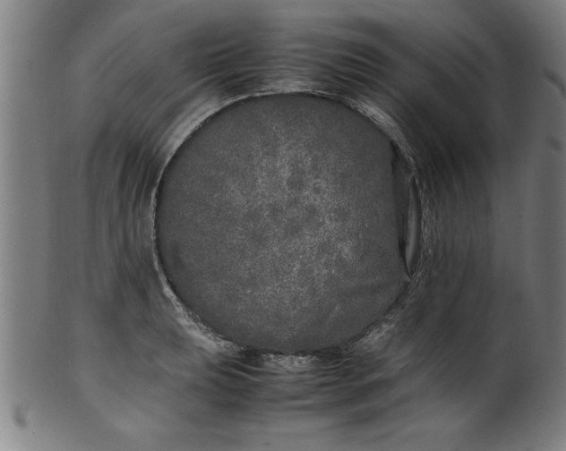 X0000099931039200806061449