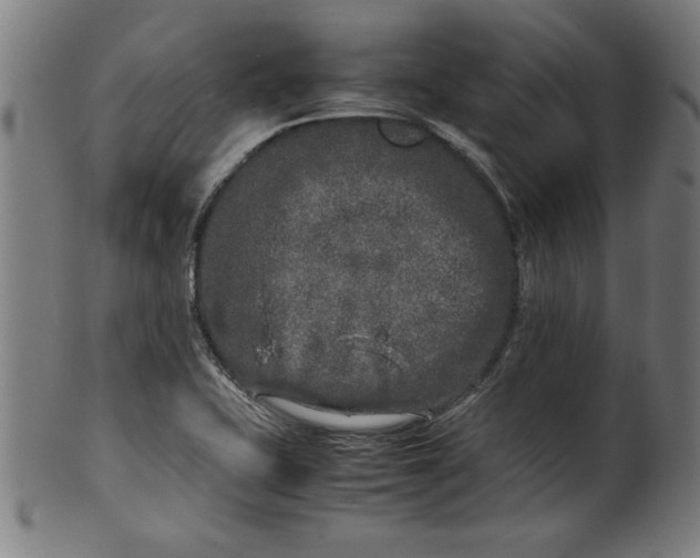 X0000099931415200806061443