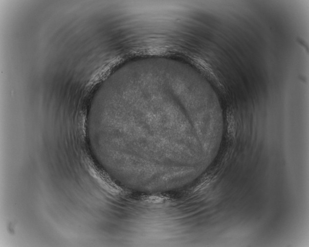 X0000099930542200806131405