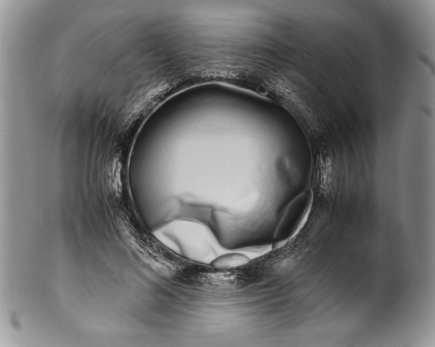 X0000099930692200806131403