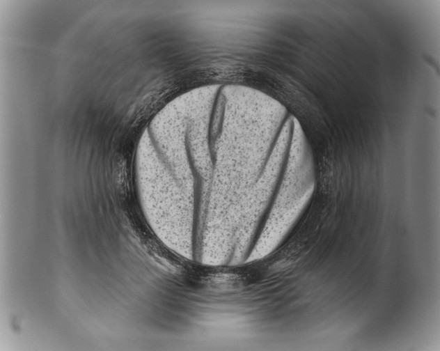 X0000099930748200806131402