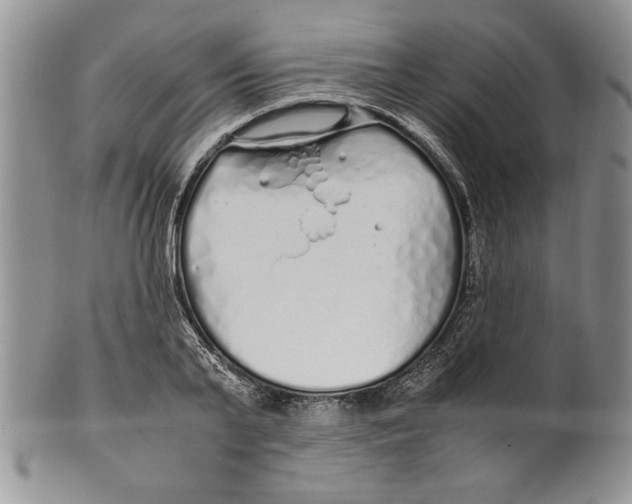 X0000099930791200806131401