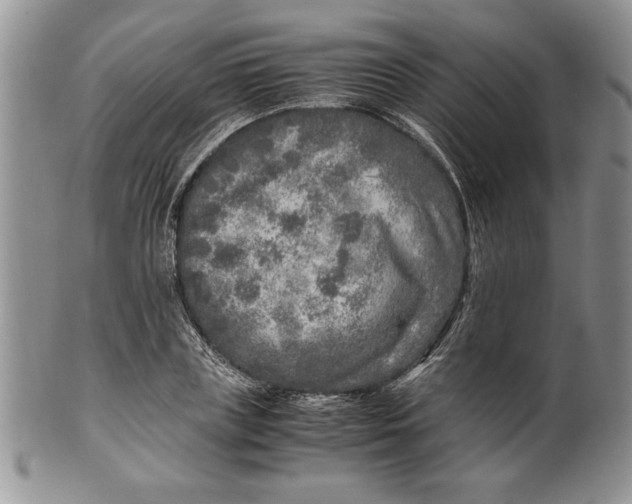 X0000099930835200806131400