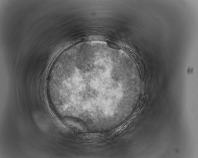 X0000099930049200806201106