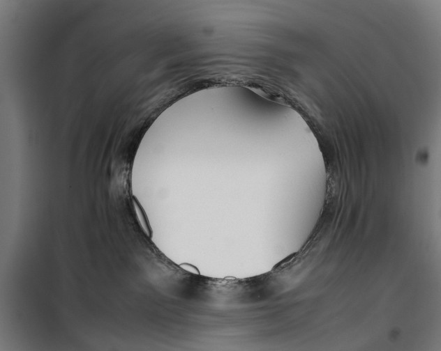 X0000099930141200806201105