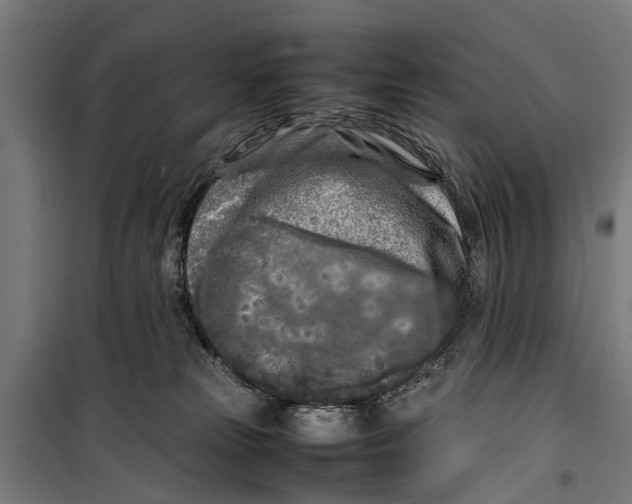 X0000099930181200806201105