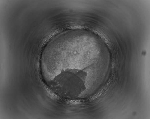 X0000099930353200806201102